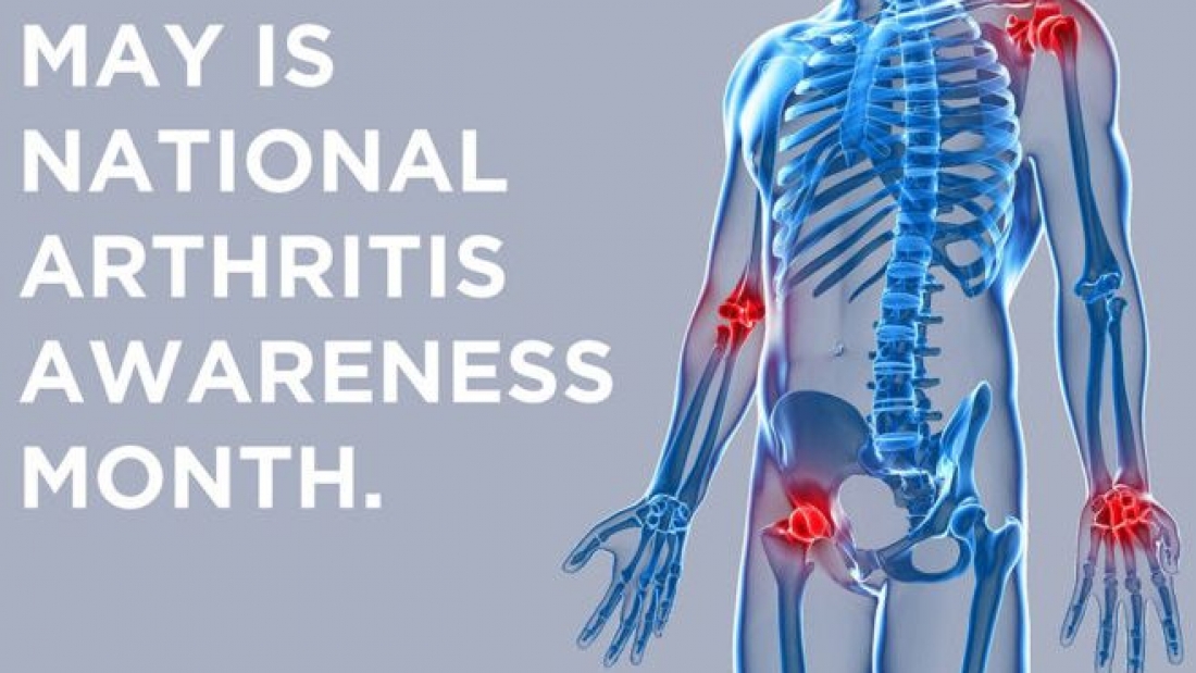 arthritis-month-post-1-e1525895169541-750x422